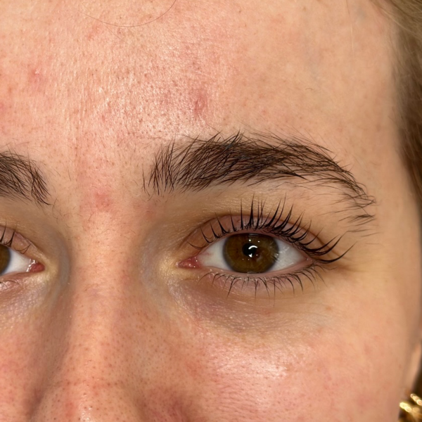 Lifting de pestañas + Botox