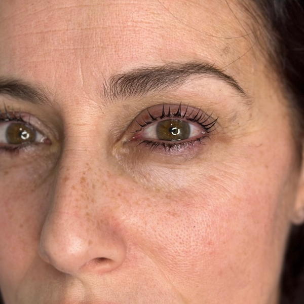 Lifting de pestañas + Botox