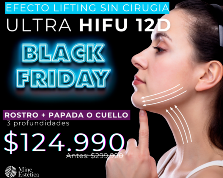 CYBER ULTRA HIFU 12D ROSTRO + PAPADA O CUELLO 