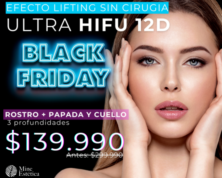 CYBER ULTRA HIFU 12D ROSTRO + PAPADA + CUELLO