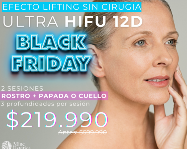 CYBER 2 SESIONES ULTRA HIFU 12D ROSTRO + PAPADA O CUELLO 