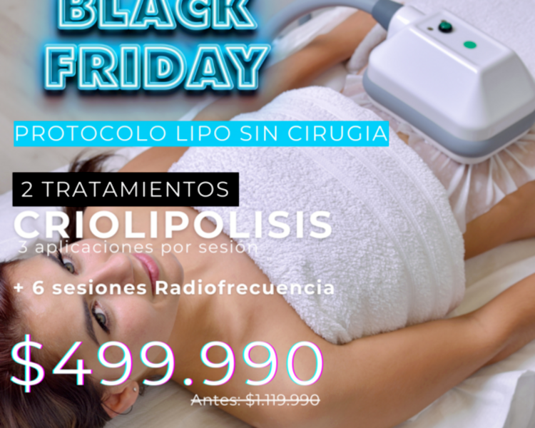 CYBER 2 SESIONES CRIOLIPOLISIS + 6 RADIOFRECUENCIA