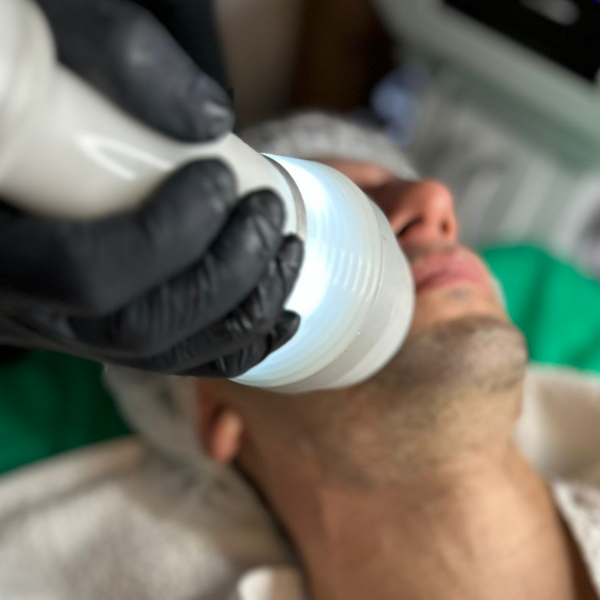 Limpieza facial+ Crioradiofrecuencia