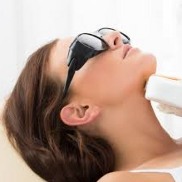 Despigmentante Cuello y Escote IPL/E-LIGHT