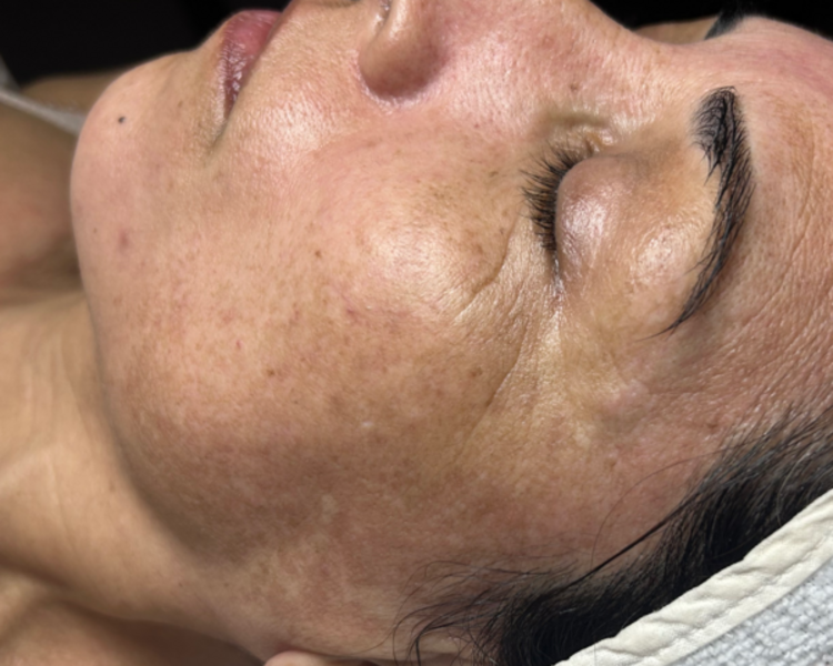 Higiene Holistica (ideal primera vez)