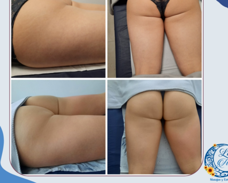 Pack tratamiento anticelulítico reafirmante (12)