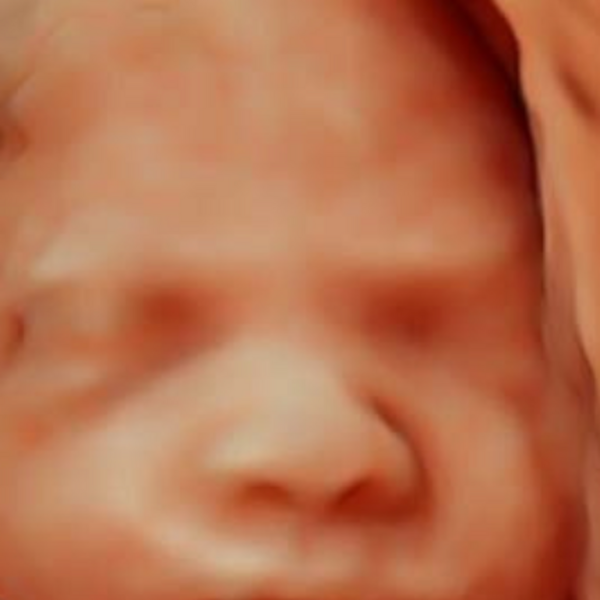 Ultrasonido de crecimiento