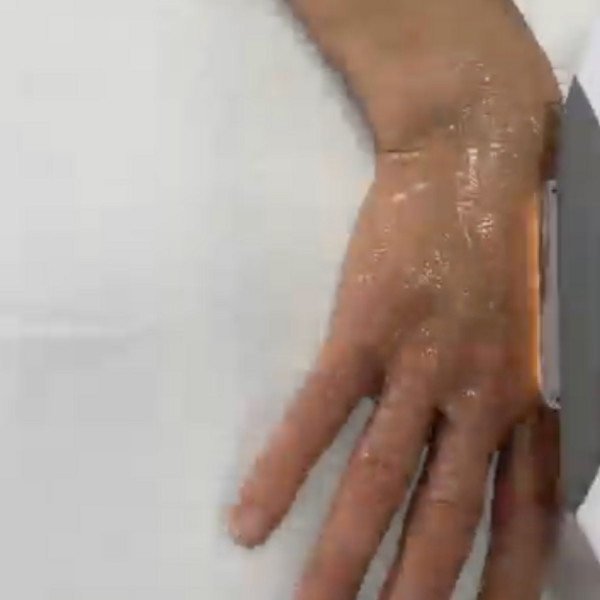 Despigmentante Manos IPL/E-LIGHT