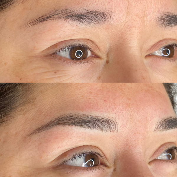 Nanoblading/Microblading