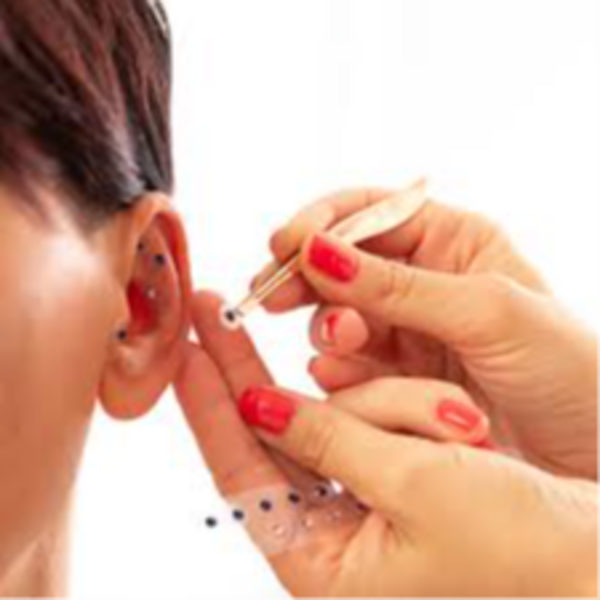 Auriculoterapia Reductiva