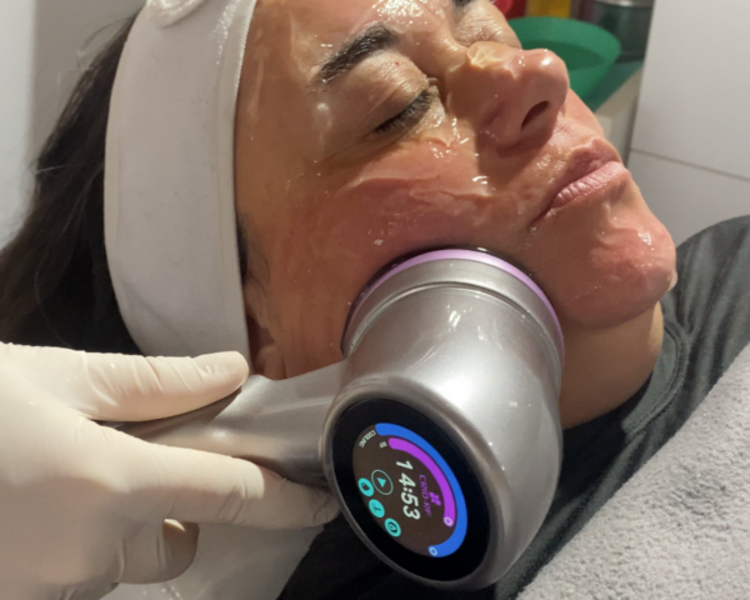 CRIORADIOFRECUENCIA facial