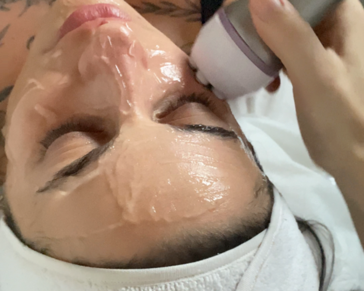RADIOFRECUENCIA facial