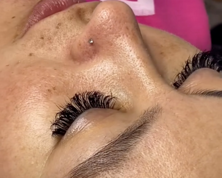 LIMPIEZA PROFUNDA + DERMAPLANING 