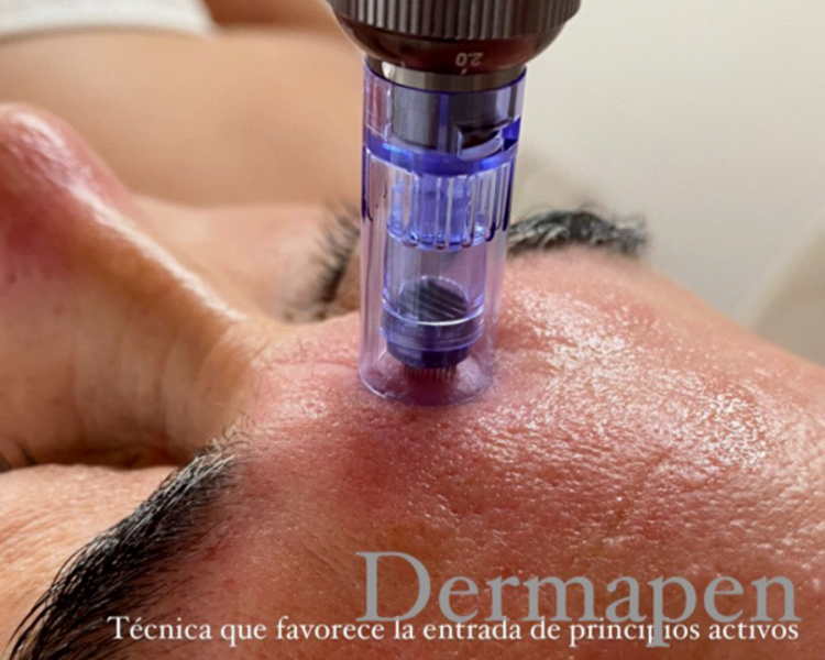LIMPIEZA PROFUNDA + DERMAPEN