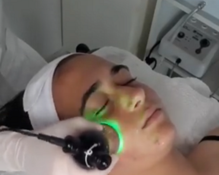 LIMPIEZA PROFUNDA + ELECTROPORACIÓN