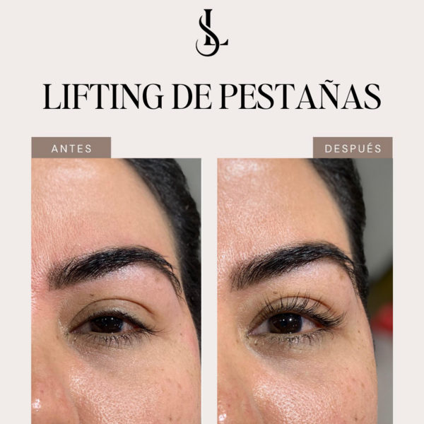 Lifting de pestañas
