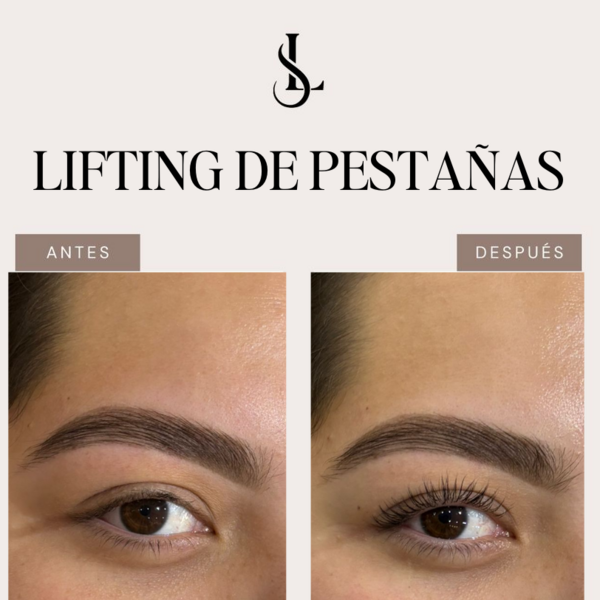 Lifting de pestañas