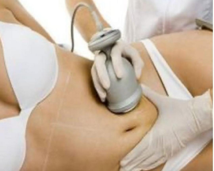 Pack Ultracavitación (Lipo sin Cirugía)