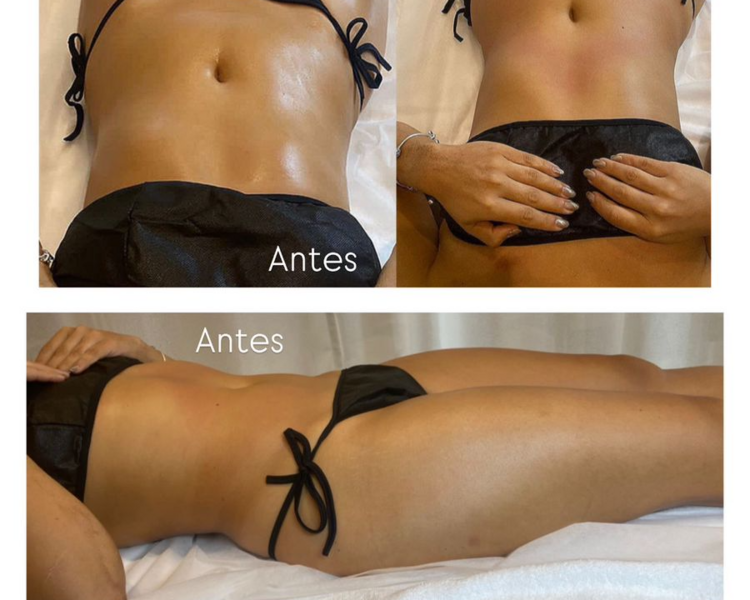 Sesión Drenaje Linfático Brasileño