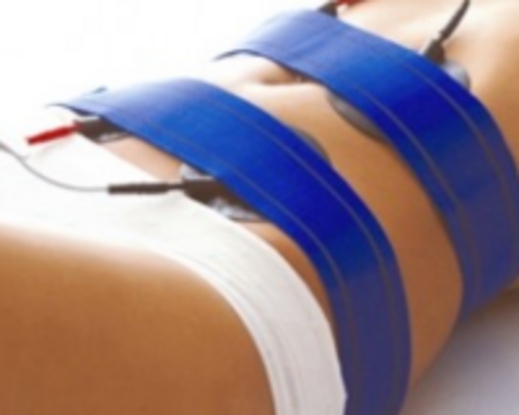 Electoestimulacion