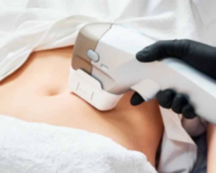 HIFU CORPORAL ABDOMEN