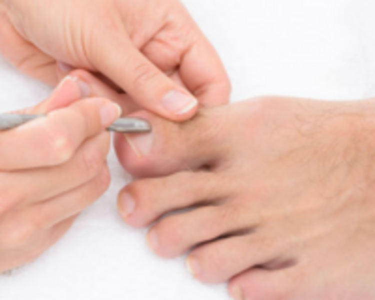 Pedicuria 