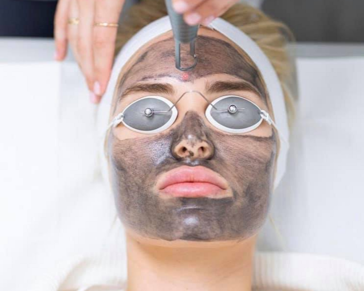 Hollywood Peel (Neatcell) 
