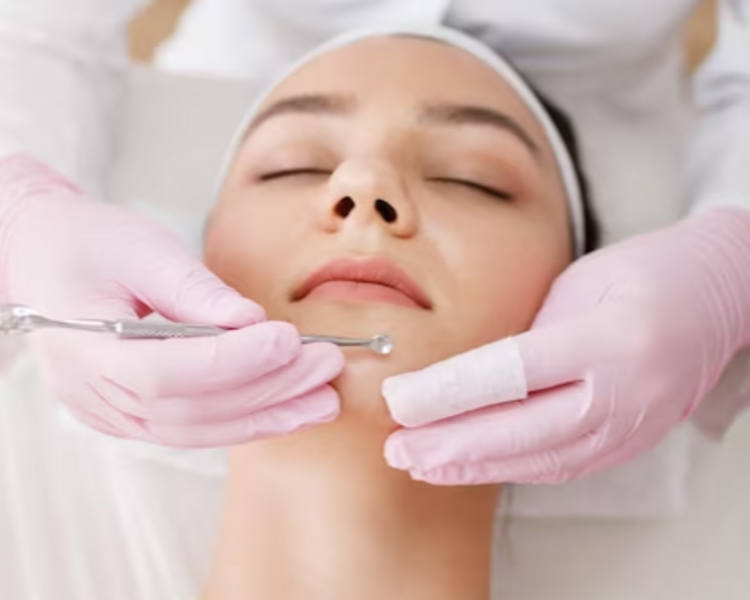 Limpieza Facial profunda con extracción de Puntos negros 