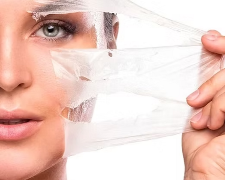 Tratamiento Peeling químico
