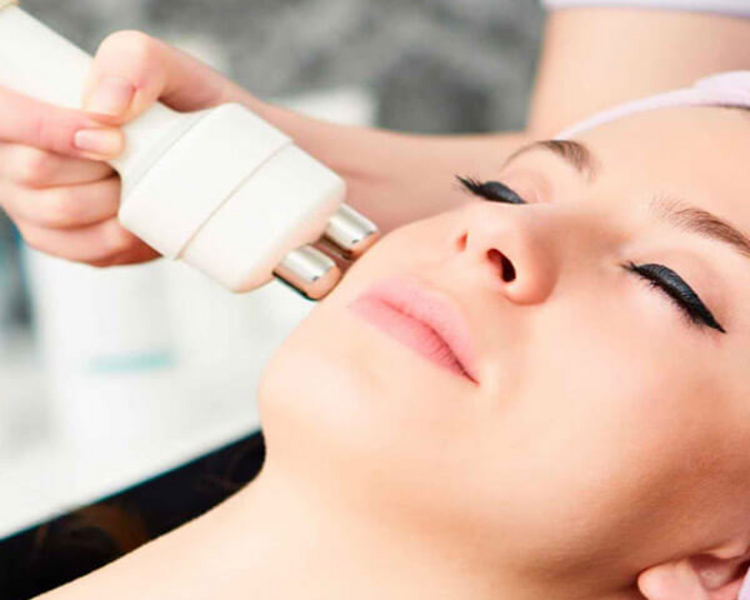 Radiofrecuencia facial (tratamiento para flacidez)