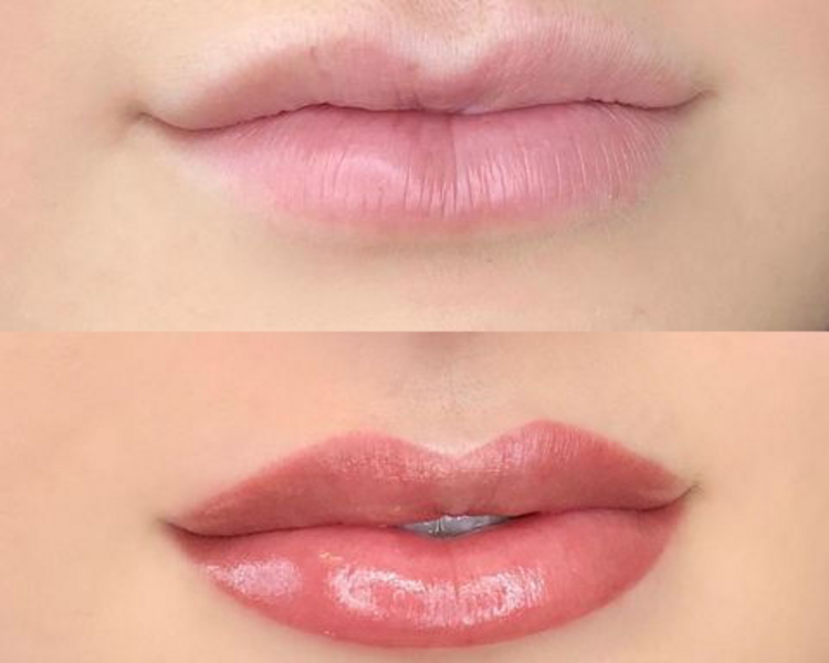 Refuerzo de Acuarela Lips