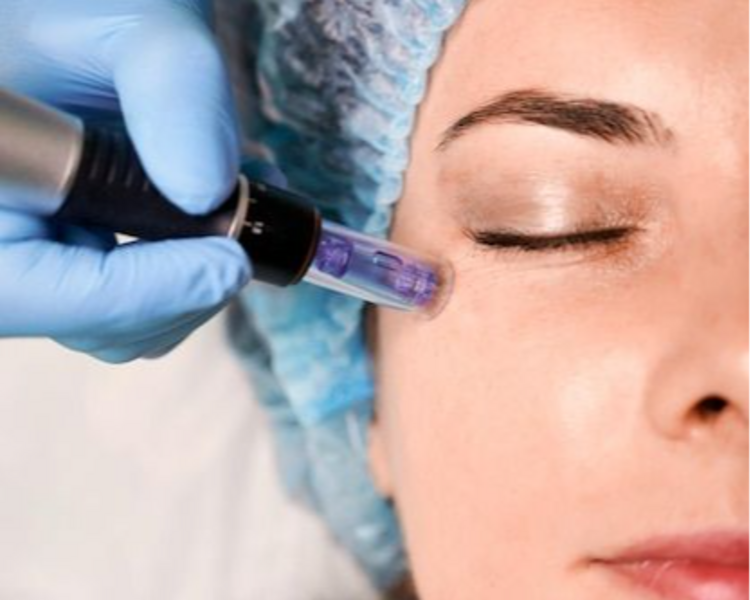 Limpieza Facial Profunda + Cóctel de Vitaminas