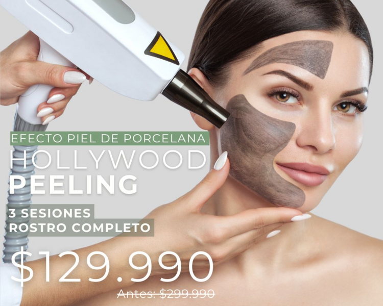 3 SESIONES HOLLYWOOD PEELING