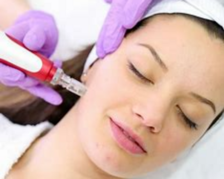 Limpieza facial profunda + dermaplaning + dermapen