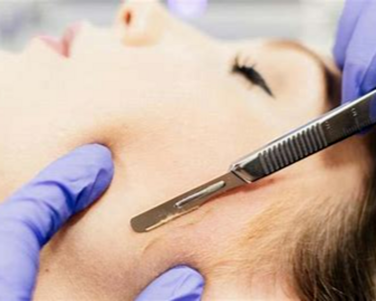 Limpieza facial profunda + dermaplaning + dermapen 