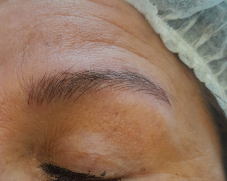 MICROBLADING