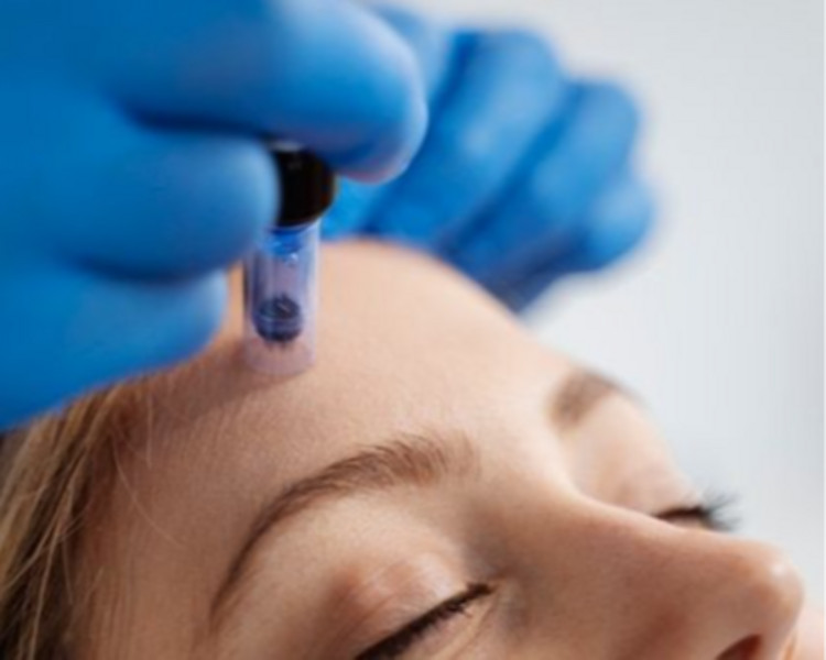 DERMAPEN (Incluye 1 Facial de Limpieza)