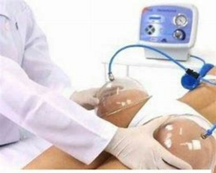 Vacumterapia