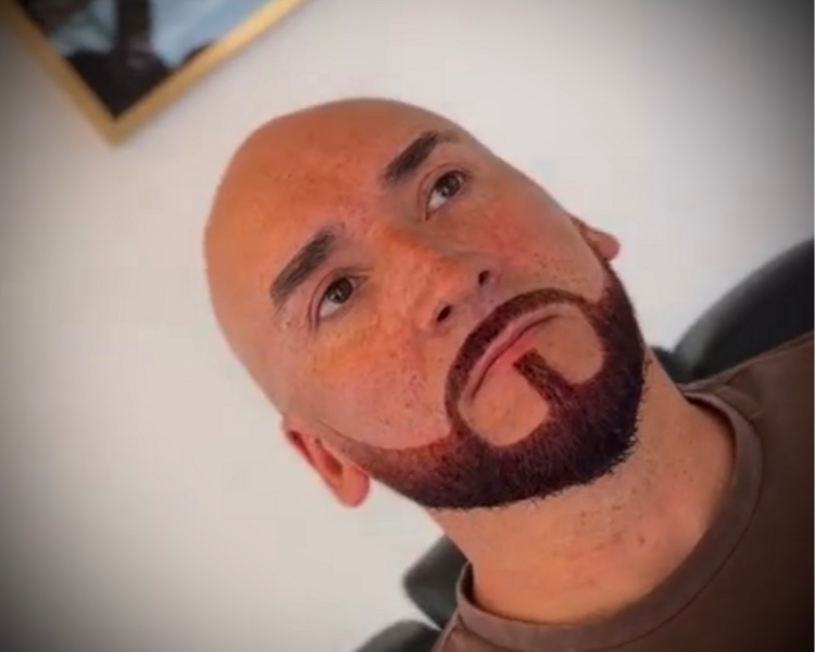 perfilado de barba