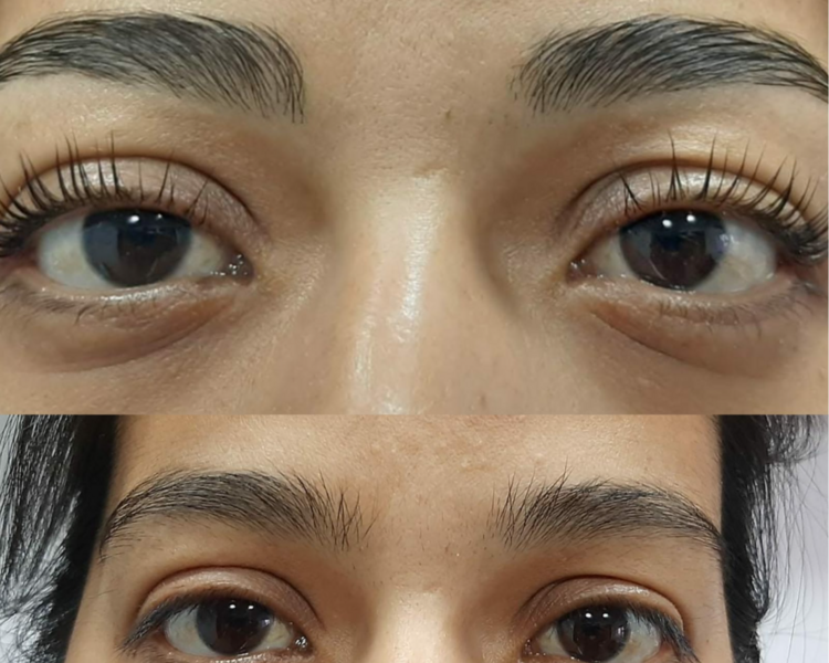 Perfilado con laminado de cejas