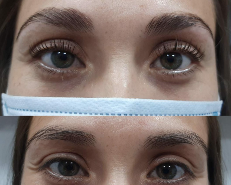 Perfilado con laminado de cejas
