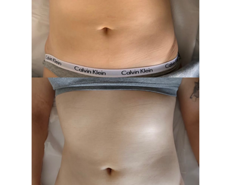Pack Cuerpo de Verano