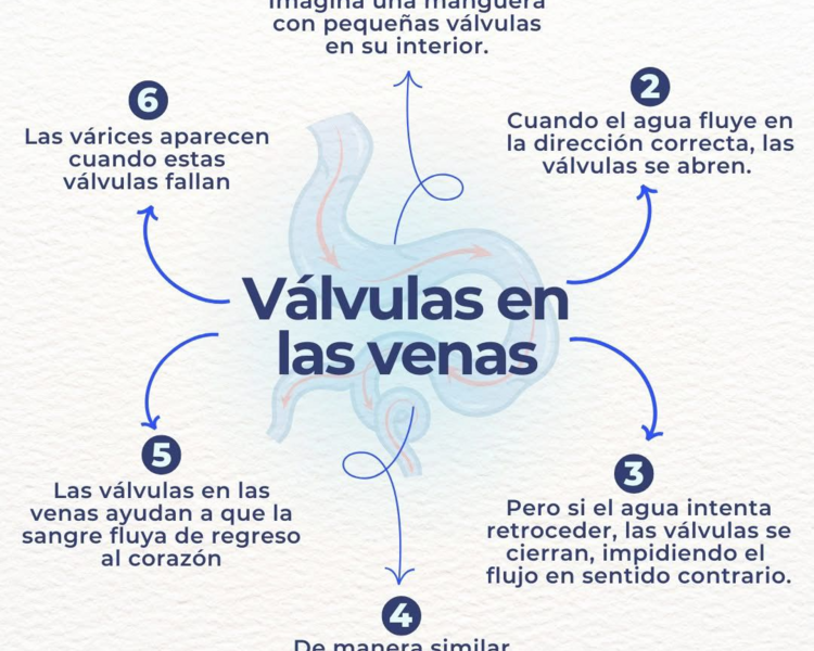 Consulta Várices Primera Vez