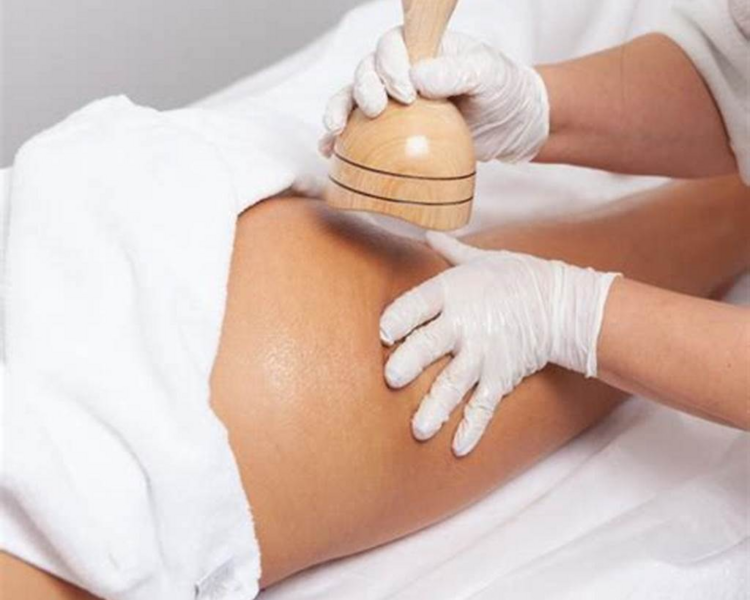 Servicio levantamiento de glúteos