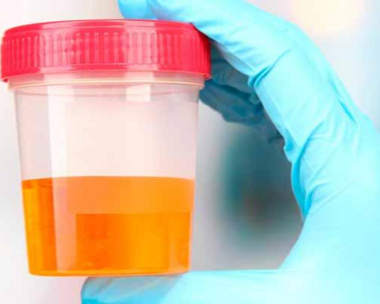 Examenes de Laboratorio