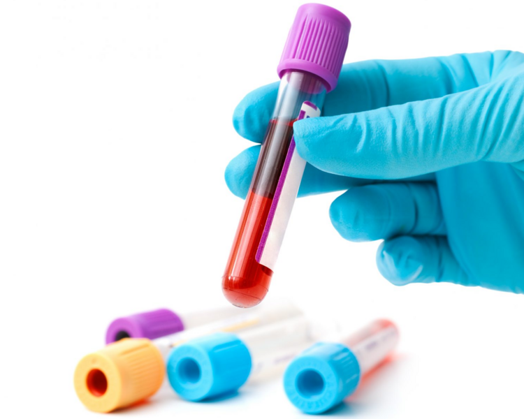 Examenes de Laboratorio