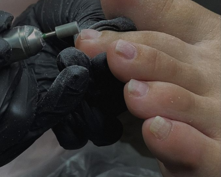 Retiro y aplicación de gel (LISO) en pies