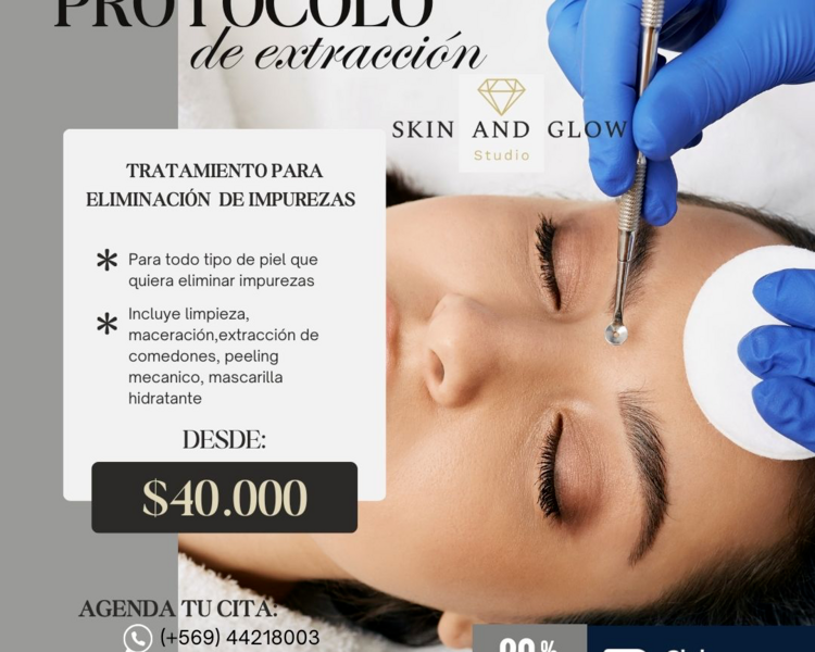 PROTOCOLO EXTRACCIÓN