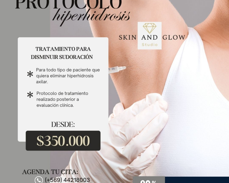 PROTOCOLO HIPERHIDROSIS