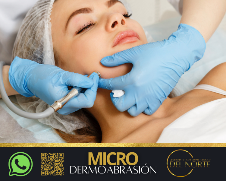 Microdermoabrasión FACIAL